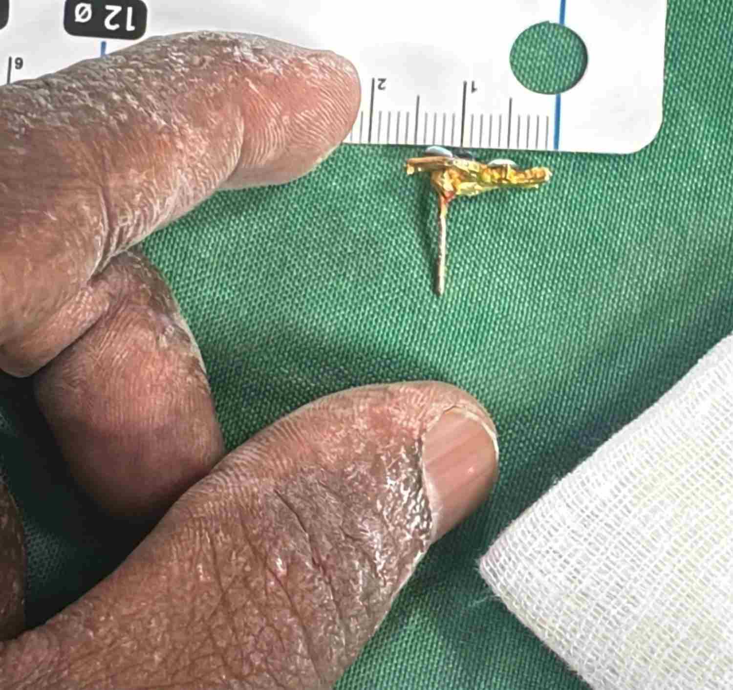 Retrieved ear ring with size measurement